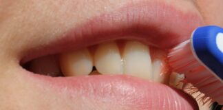 Karang Gigi Bandel? Cara Membersihkannya Tanpa Harus ke Dokter! cara membersihkan karang gigi