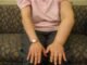 Kenali Limfedema, Pembengkakan yang Bisa Muncul Setelah Pengobatan Kanker Kenali Limfedema, Pembengkakan yang Bisa Muncul Setelah Pengobatan Kanker